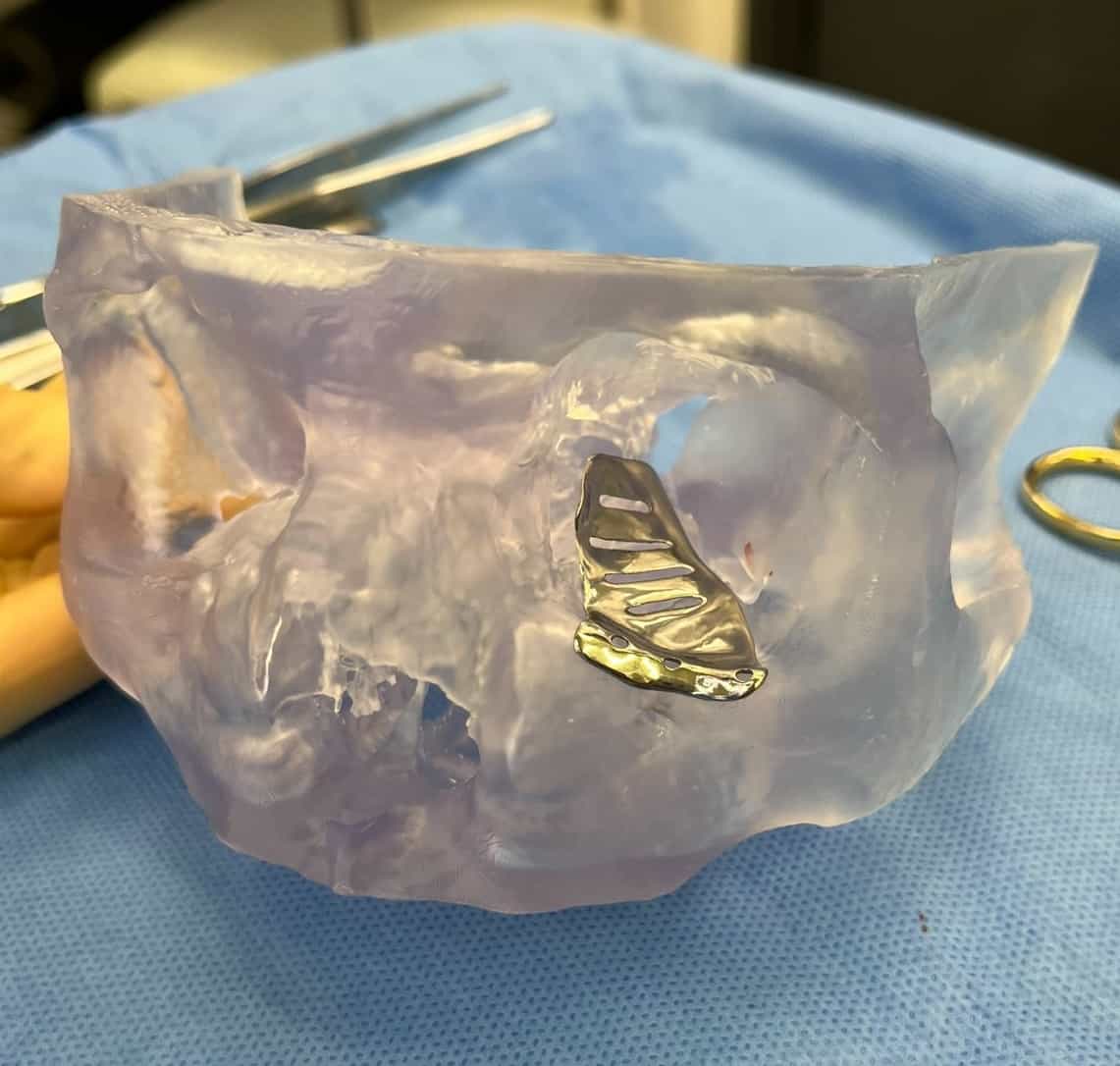 Cranio-maxillofacial Cranio-maxillofacial