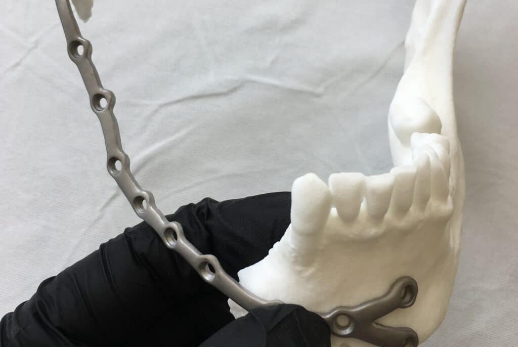 Cranio-maxillofacial Cranio-maxillofacial