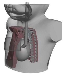 Chest Drain Trainer