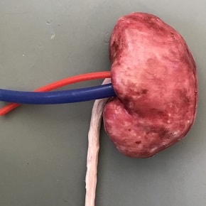 Kidney Simulator