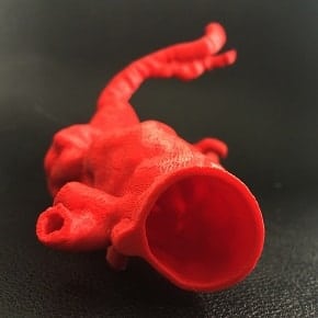 3D model for endovascular aneurysm repair