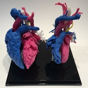 Two congenital cardiology models